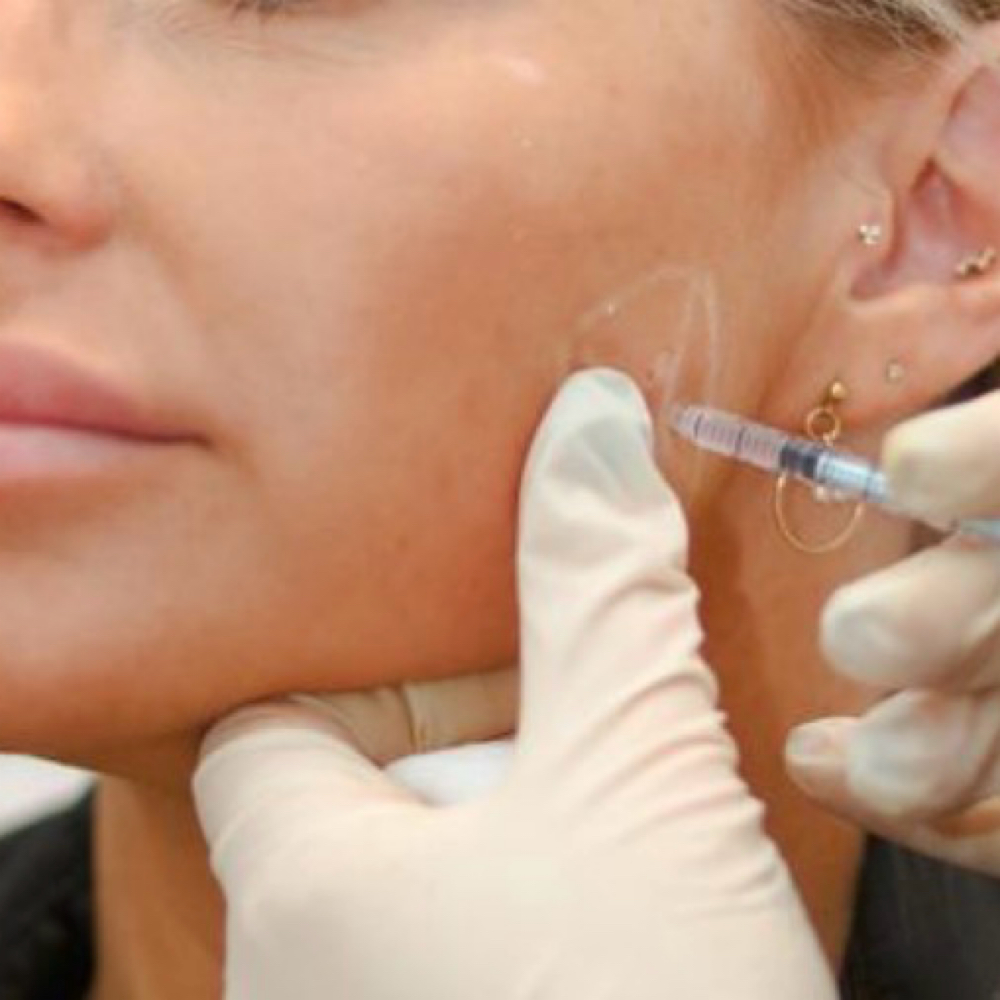 Masseter Injection at Precision Aesthetics LLC in Harrodsburg, KY