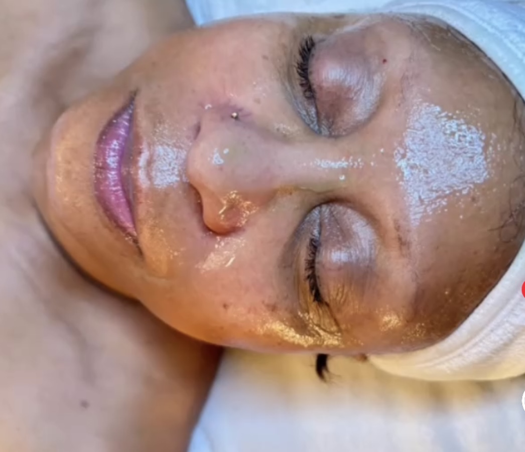 New to Peels