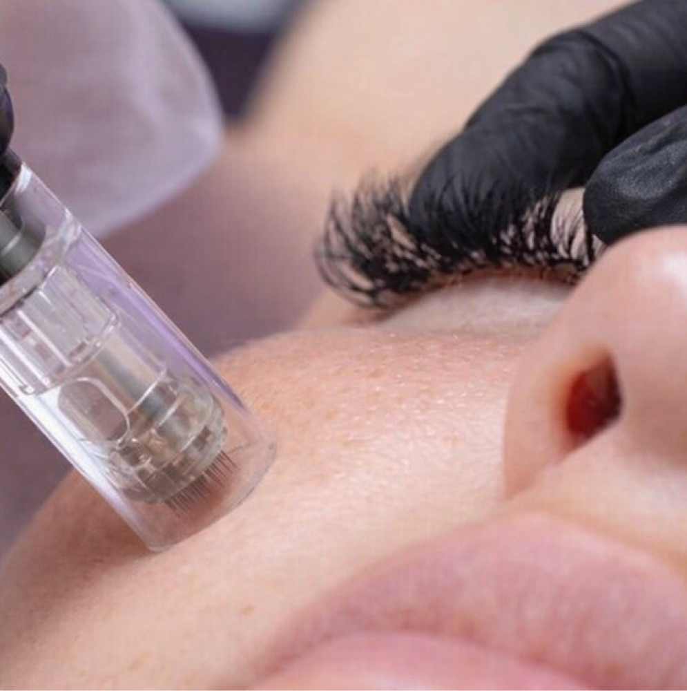 Microneedling w/o RF