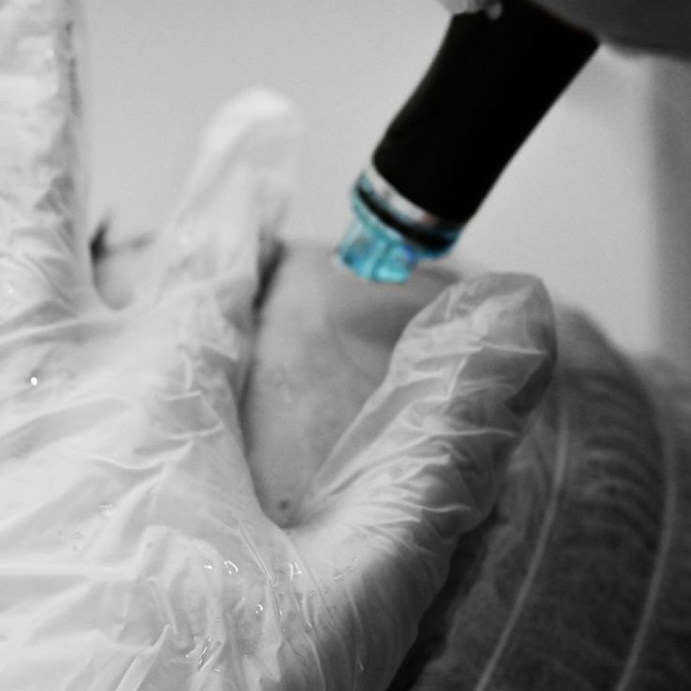 Signature Body Hydrafacial at ABC Aesthetics in Baltimore, MD