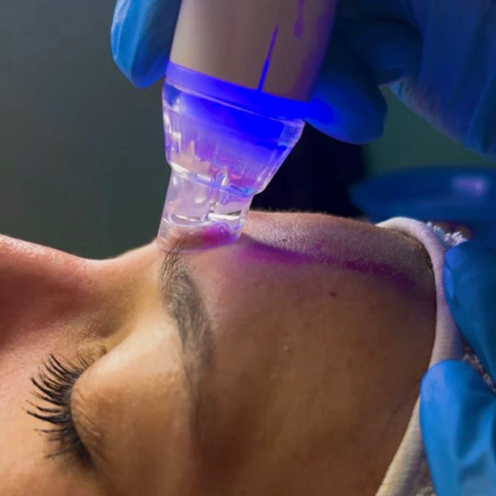Hydra Deep Cleanse at BrillaBellezaTouch in Hope Mills, NC