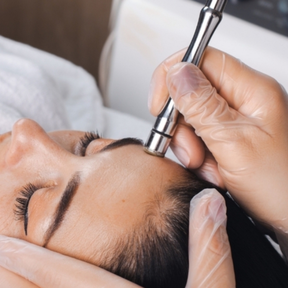 Microderm at Bubalu Skin in Elgin, IL