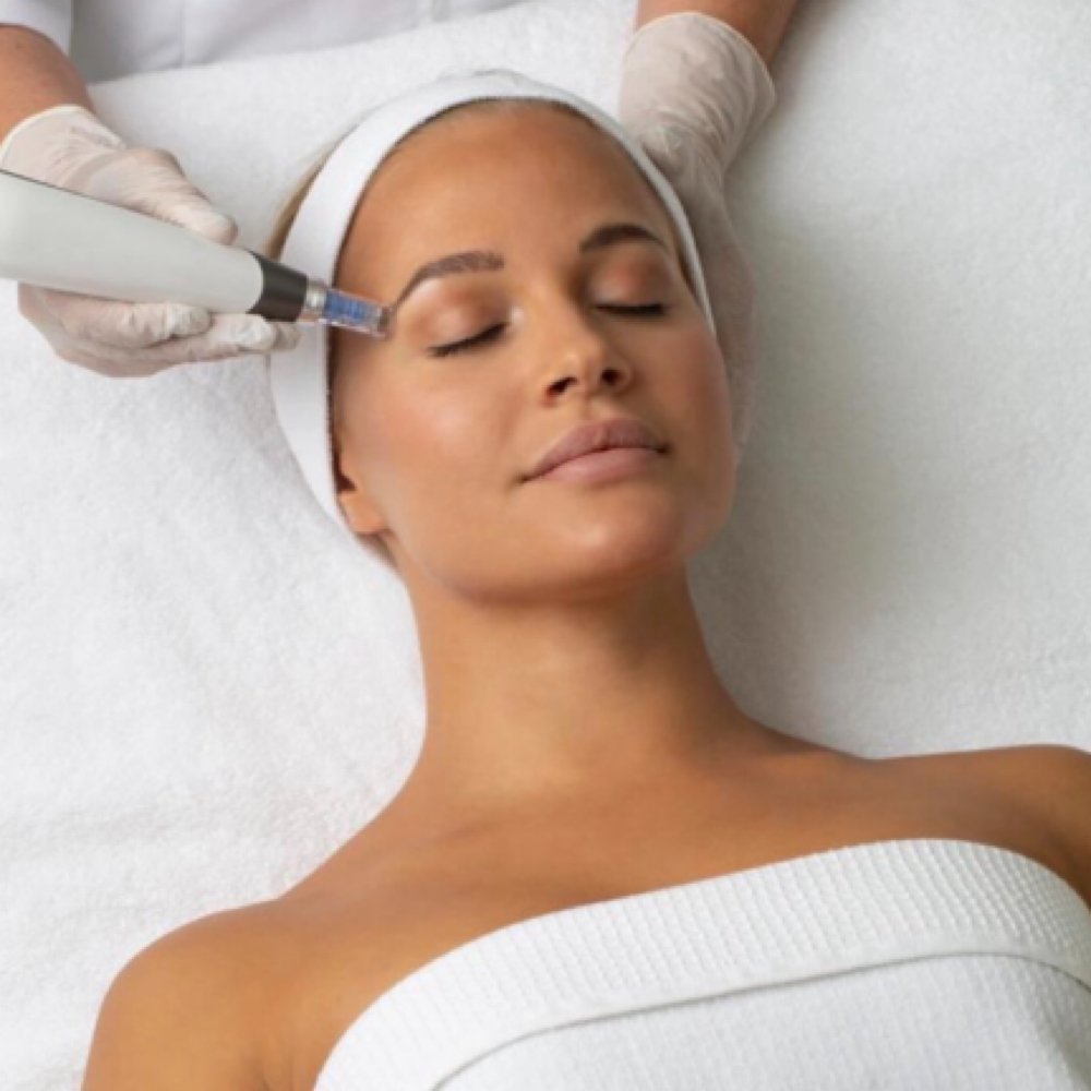 Exosome Microneedling — Face + Neck at Sunshine Esthetics Lounge in Lake Mary, FL