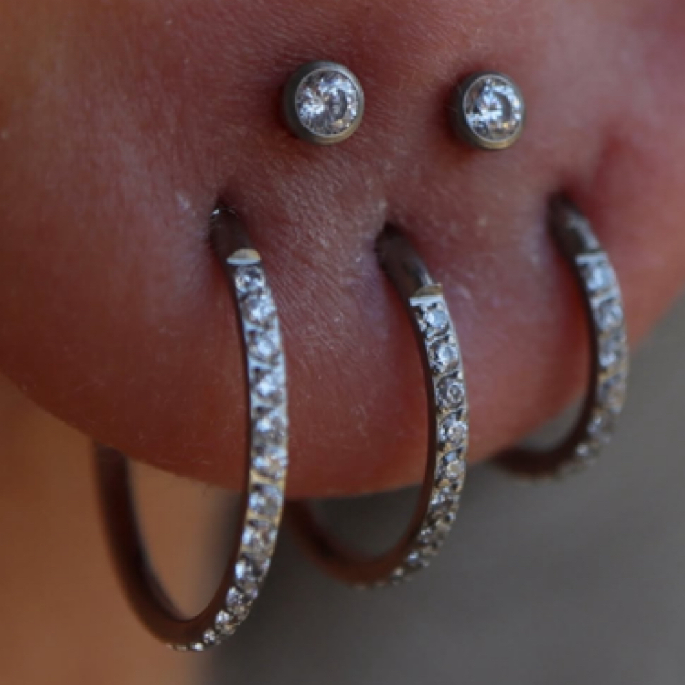 Piercing Removal at LauLux Esthetics in Bellerose, NY