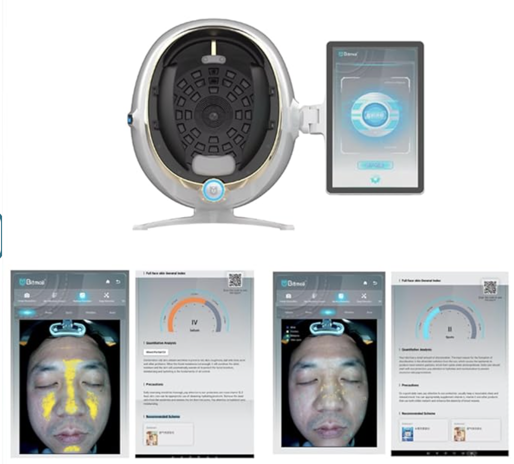 Skin Analysis