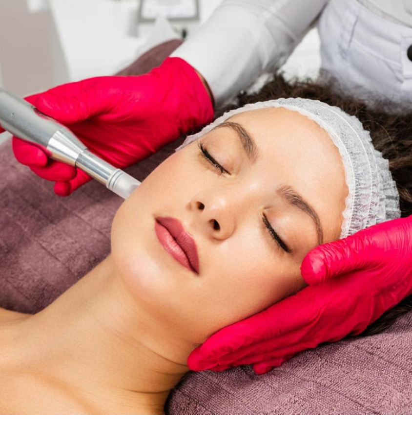 Microneedling at Optimist Aesthetics LLC in Kingsville, TX