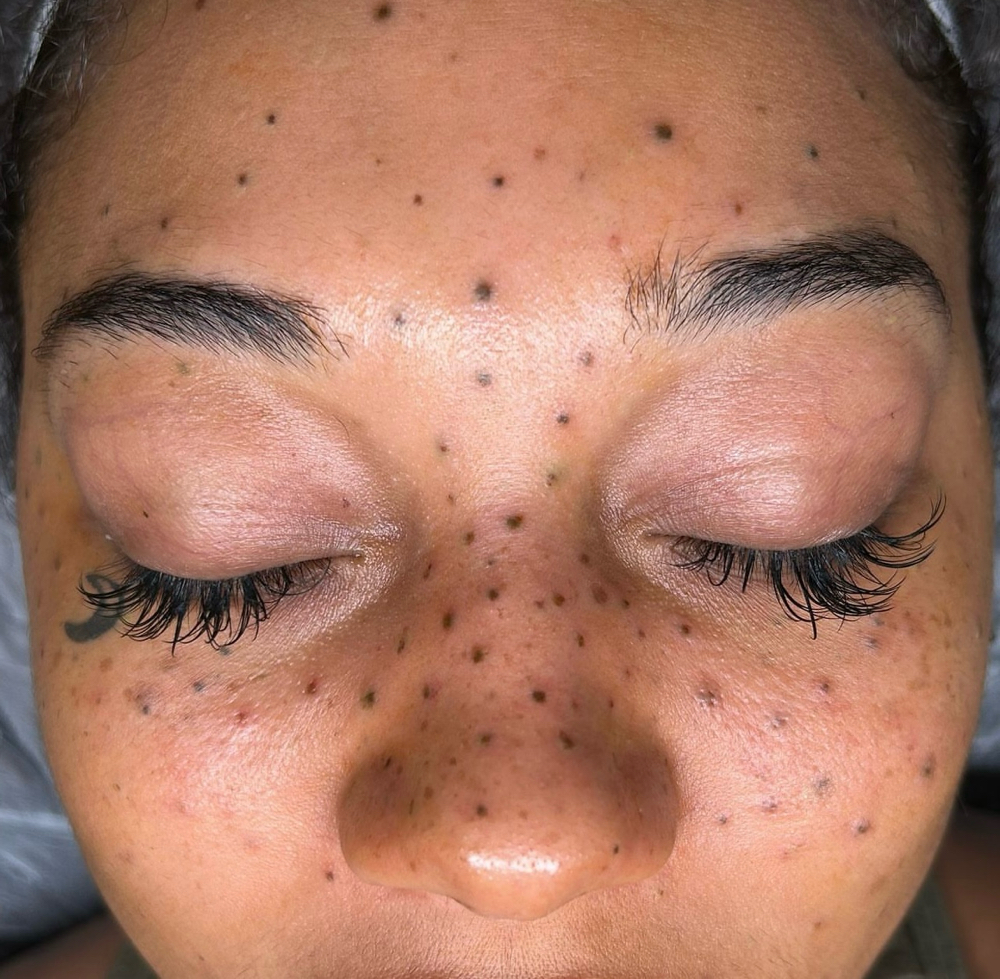 Semi Permanent Freckles