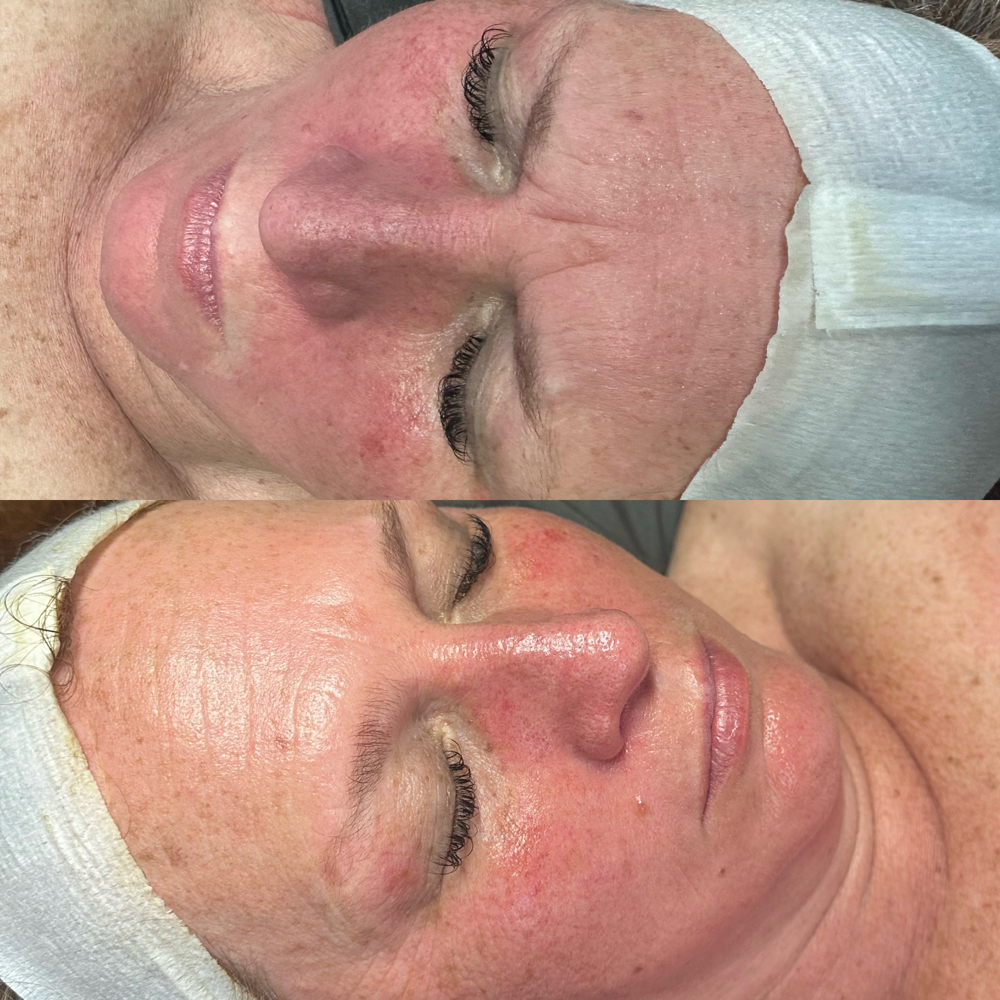 C B D/Hemp Cell Basic Facial