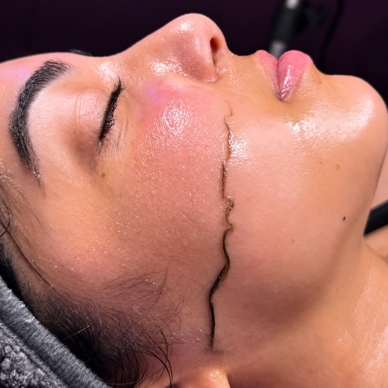 PIEL | DERMAPLANING at EROXSPA in Houston, TX