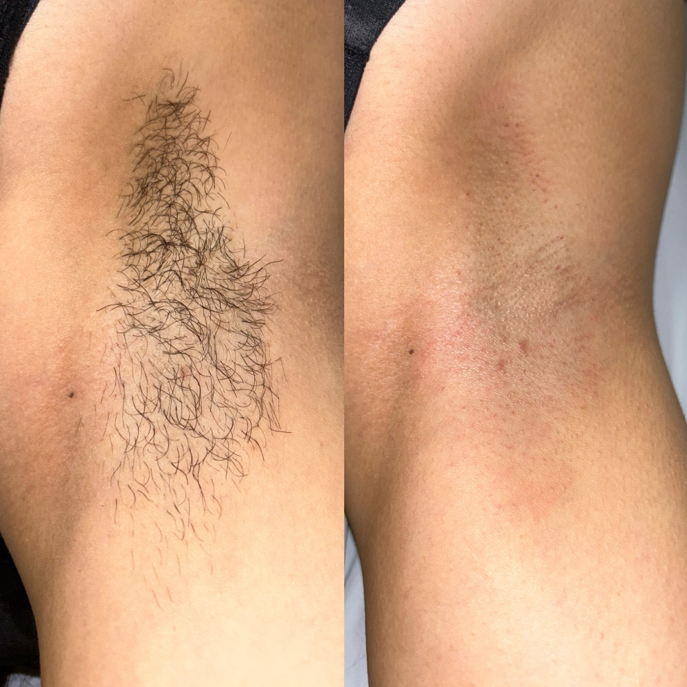 Under Arm wax at Bloom Beauty Bar in Vernal, UT