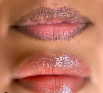 Lip Neutralization