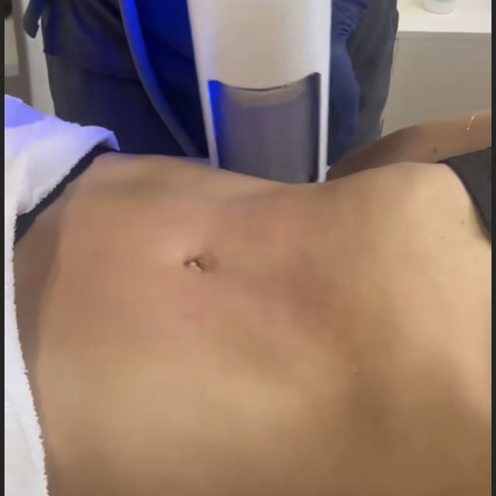 Endospére Body Therapy(pkg X5) at Radiance Beauty Studio in McAllen, TX