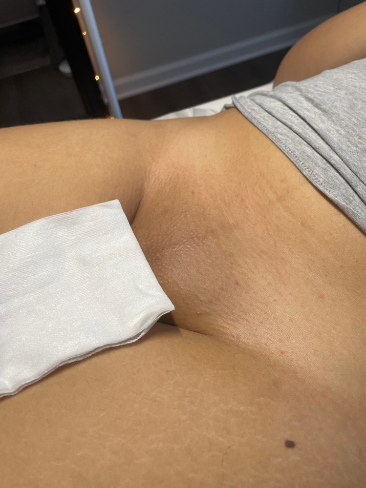 Brazilian Wax