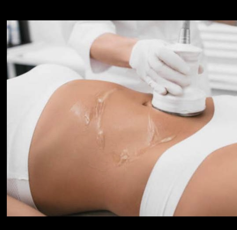 Body Sculpting Treatment