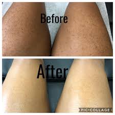 Waxing - Upper Leg