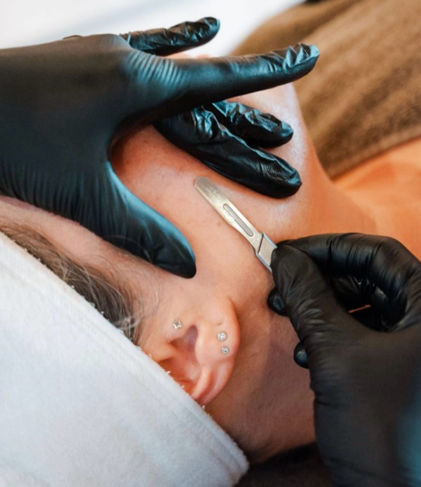 Dermaplane Add On at Elevate by Elle in Junction City, KS