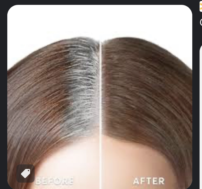 Root Retouch