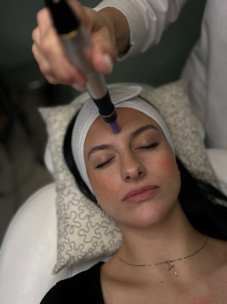 Micro-Needling - Collagen Induction Therapy (PCIT).