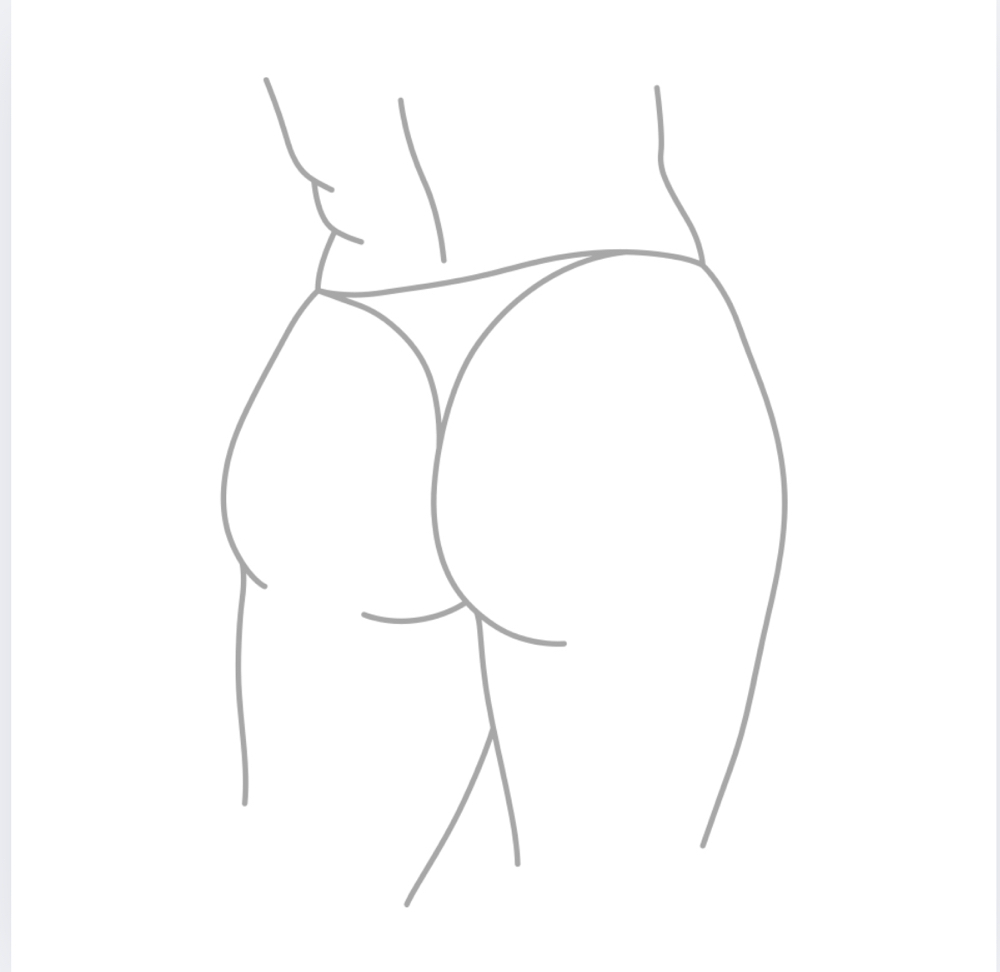 Buttocks LHR at SkinFix Laser Hair Removal in Richland, WA