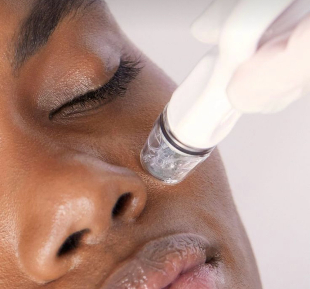 Hydrodermabrasion