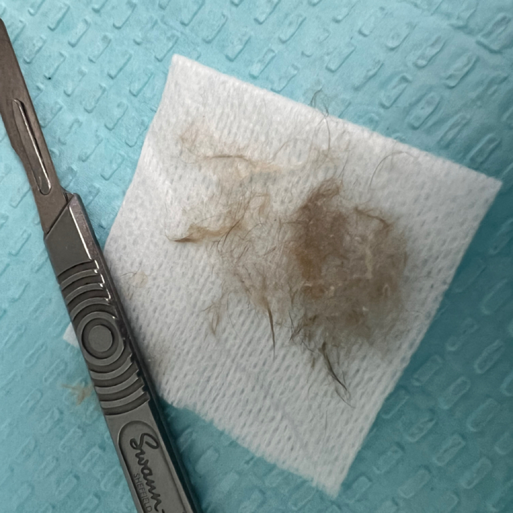 Dermaplane Add On at Katherine  Booth SKINCARE & SPA in Lynchburg, VA