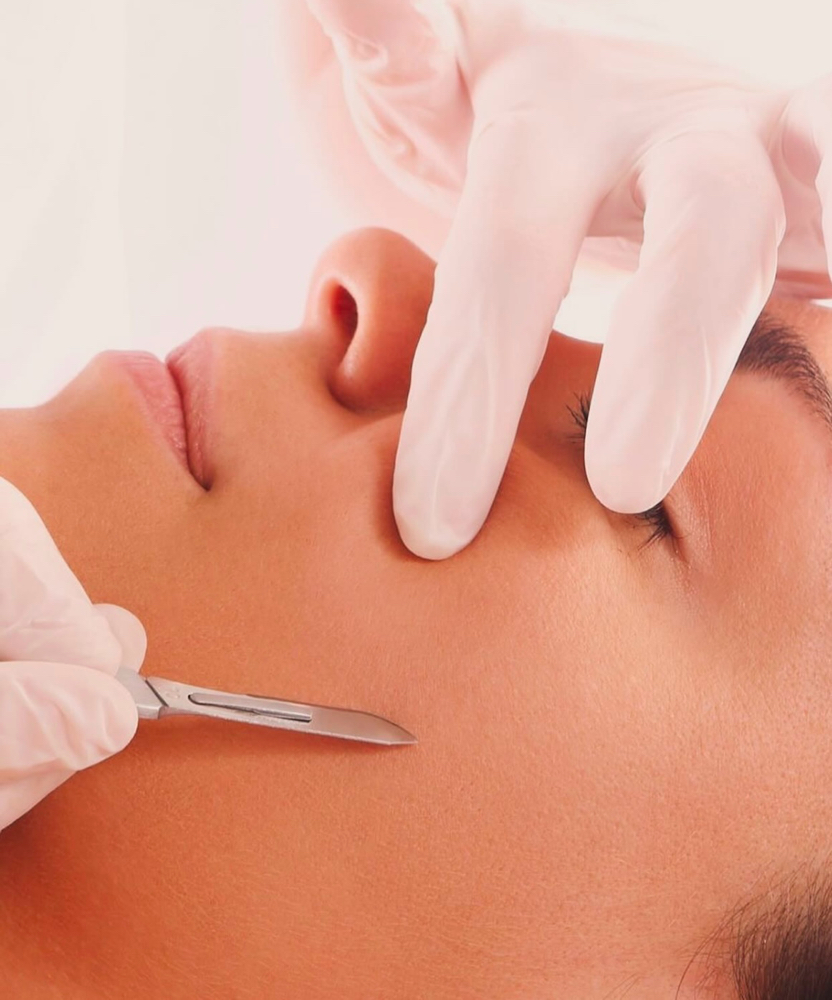 DERMAPLANING