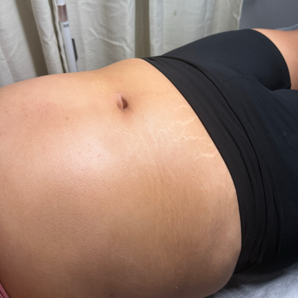 Full Stomach Wax at Polishedbypocha in Fort Worth, TX