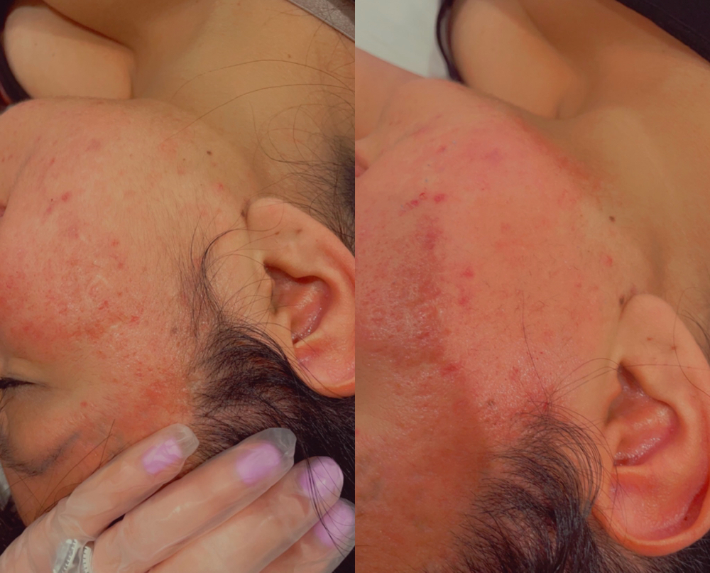 Chin/ Side Burns Wax