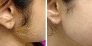Sideburn Waxing