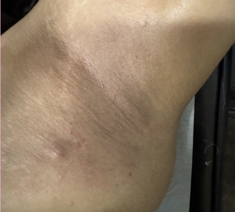 Under Arm Wax at A’Nicole Beauty Bar in Mesquite, TX