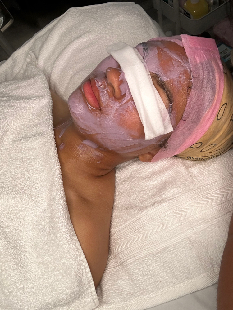 Microdermasion facial