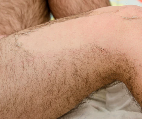Brazilian and Full Leg Wax