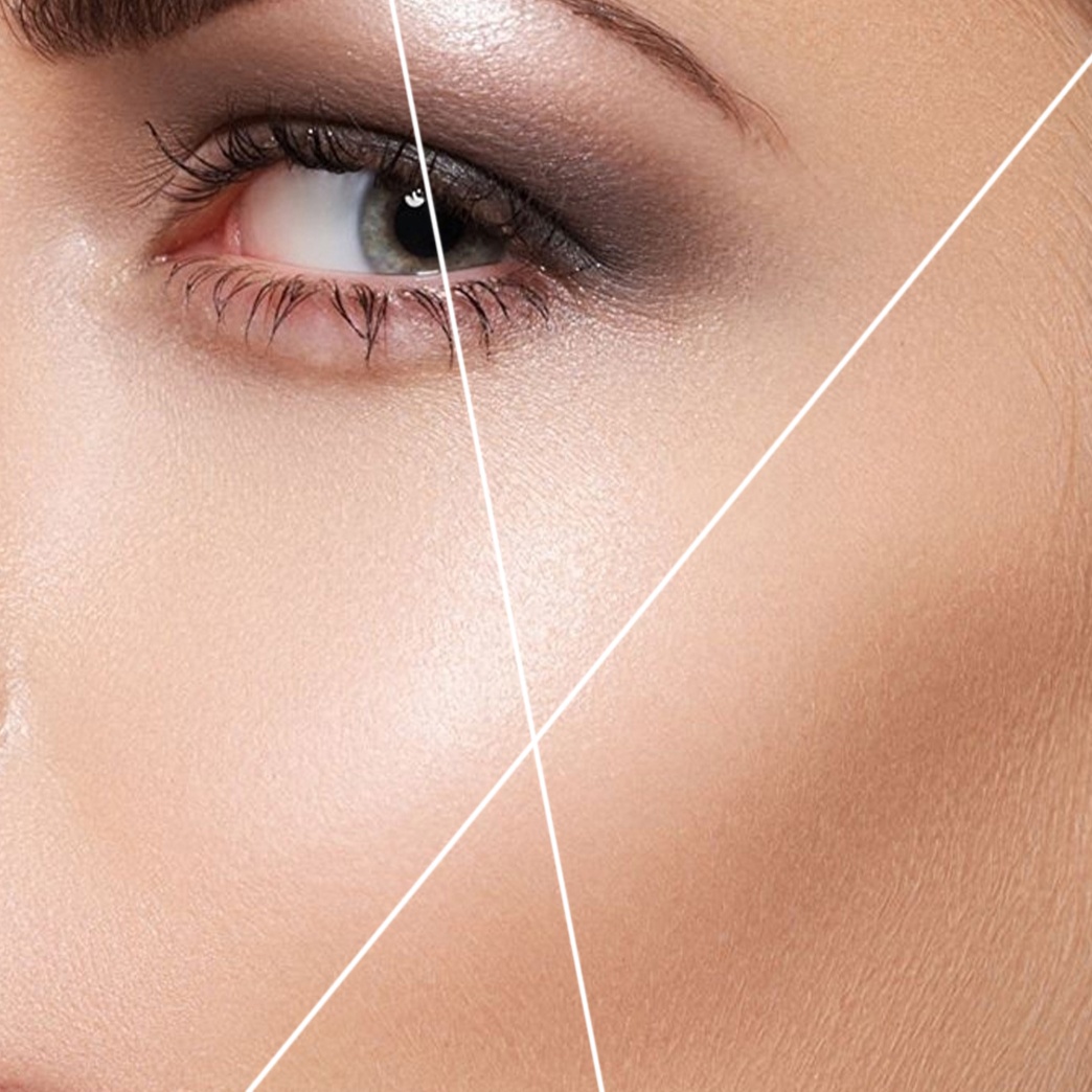 Full Face, Eyebrow, Neck And Mask at AR Touch in Marietta, GA