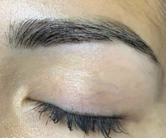 Waxing - Eyebrow, Lip, Or Chin