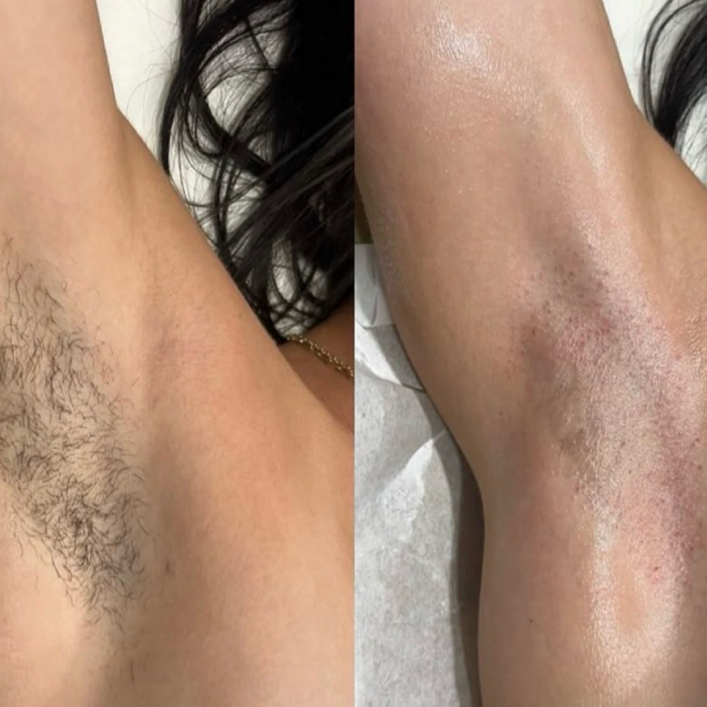 Underarm Wax at BADNBOUGEE NAILS & BEAUTY SALON in Yakima, WA
