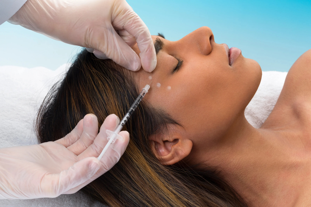 Bótox FOREHEAD & CROWSFEET