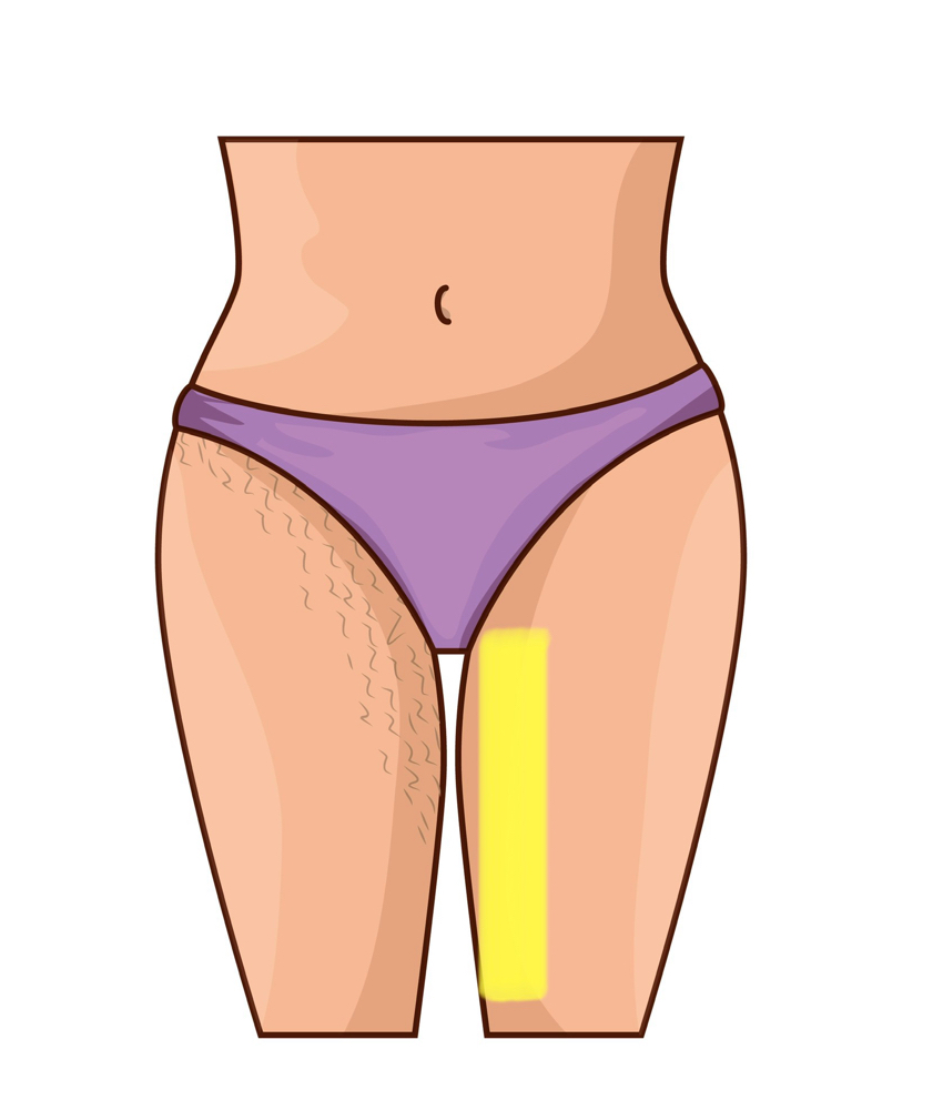 Thighs (Inner)
