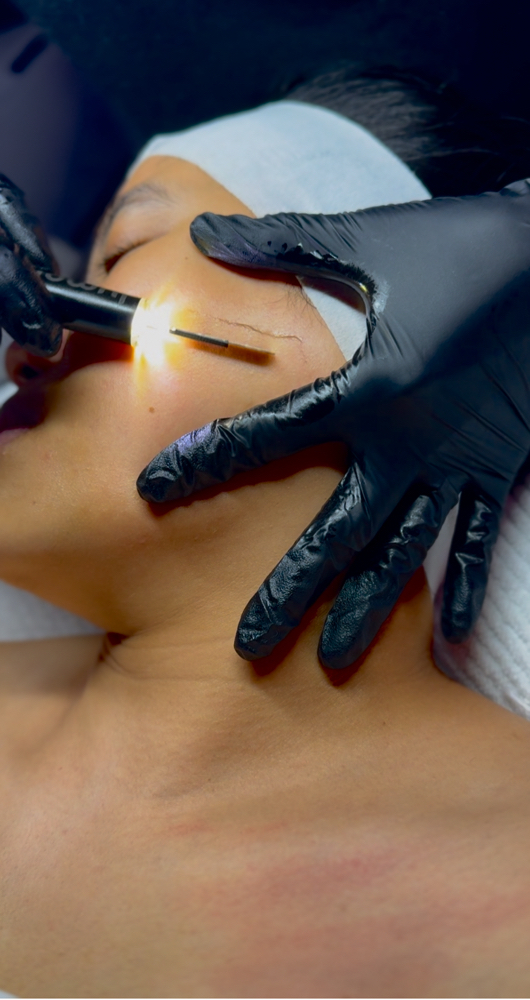 Dermaplane Facial