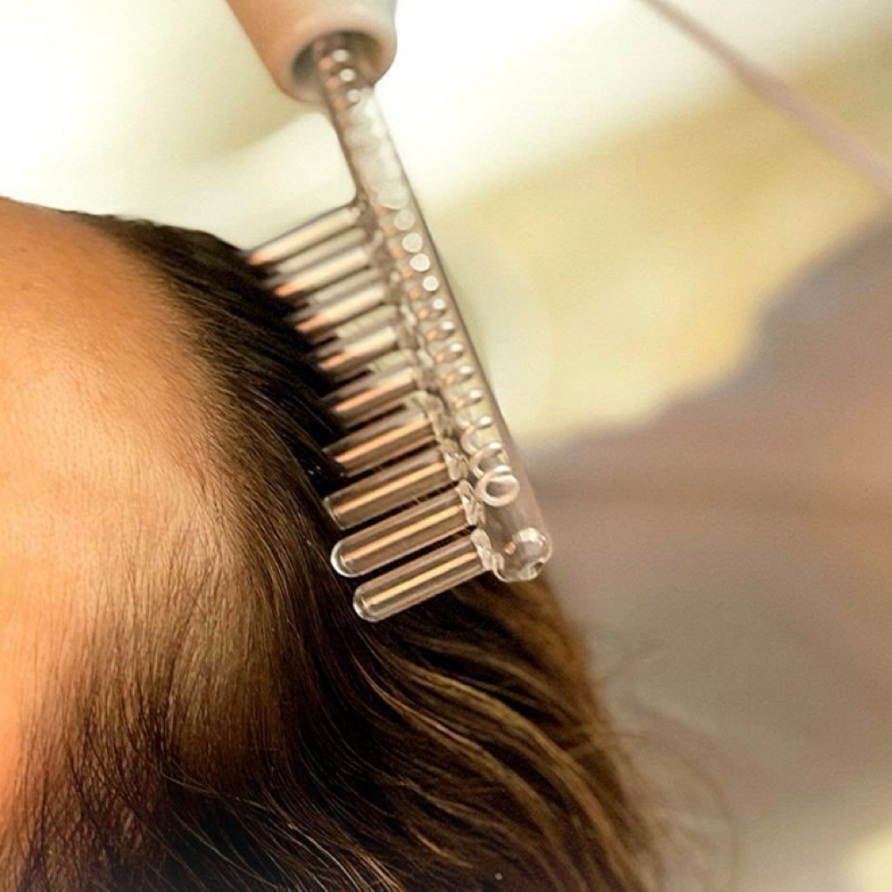 HAIR GROWTH STIMULATION TREATMENT at Kayla Jane Esthetics in Atascadero, CA