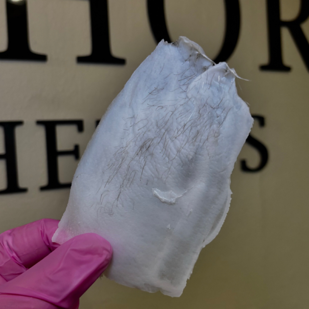 Underarm Wax at Windhorse Esthetics in Loveland, CO