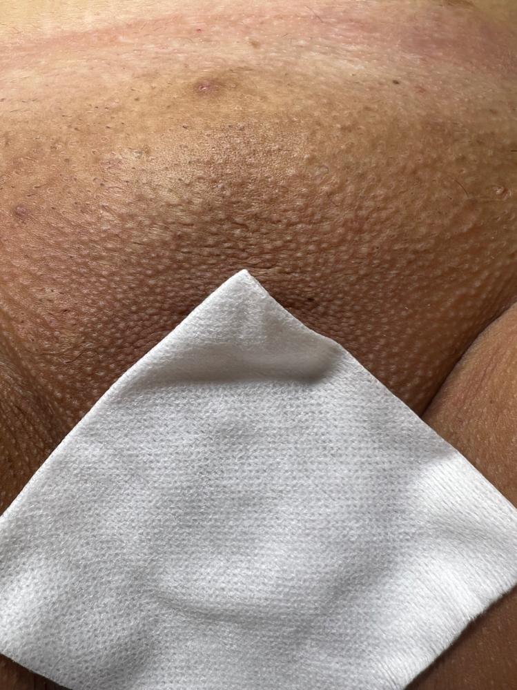 Brazilian Wax