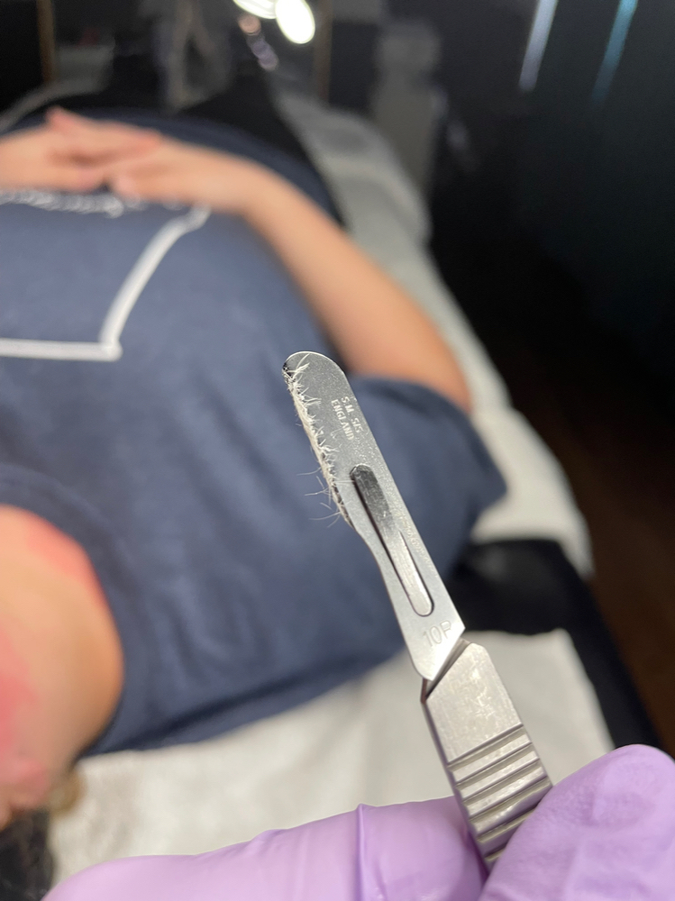 Dermaplane Add On To Facial