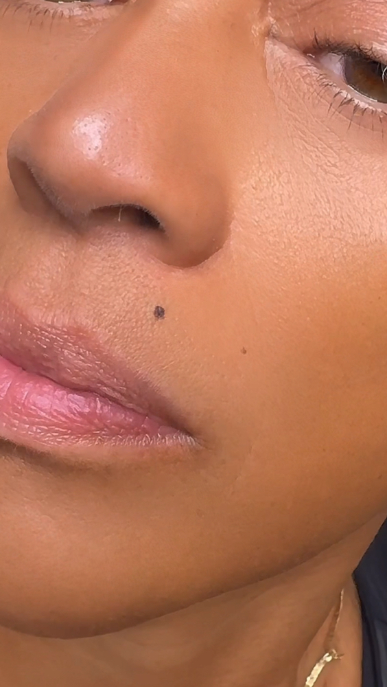 Beauty Marks/Mole