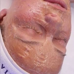 Zombie Firming Peptide Facial at Omnia Esthetics in Menomonie, WI