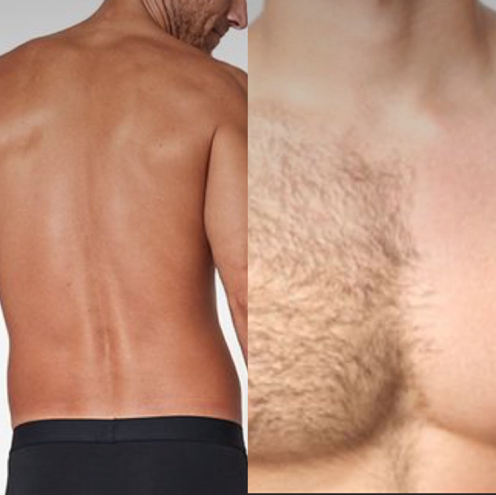 Back & Chest Wax