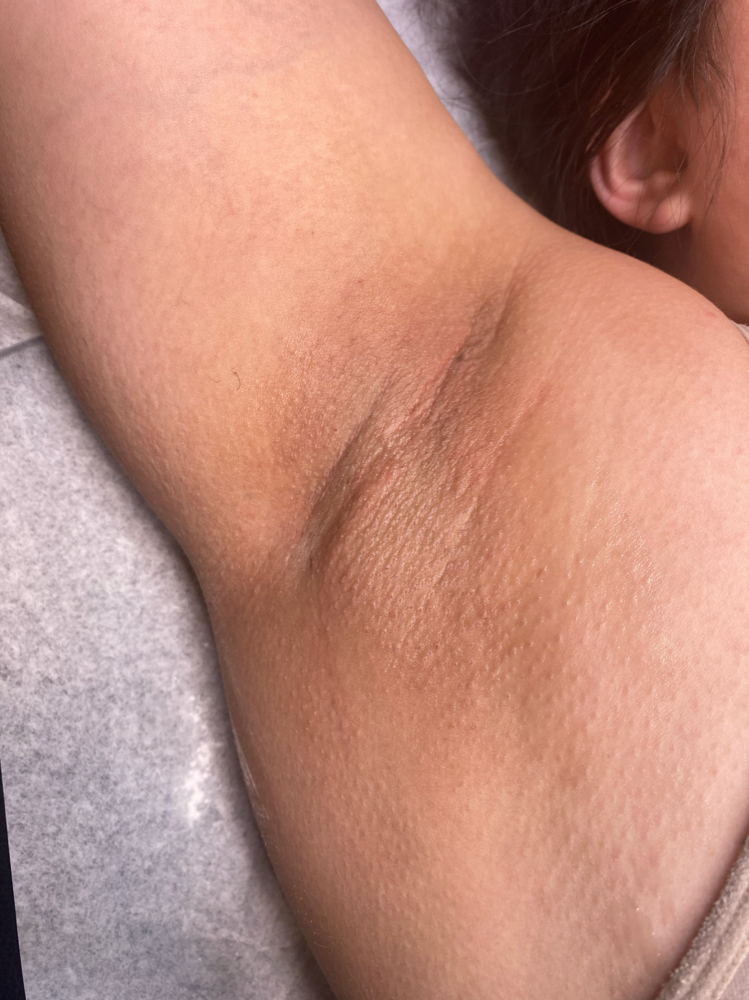 under arms waxing at DiamondTheEsti in san antonio, TX