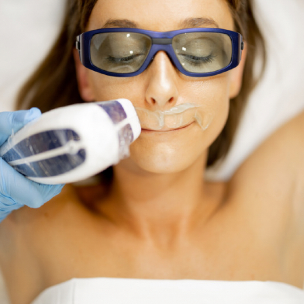 upper lip LASER HAIR REMOVAL at BEAUTY LAB COLLECTIVE in Miami, FL