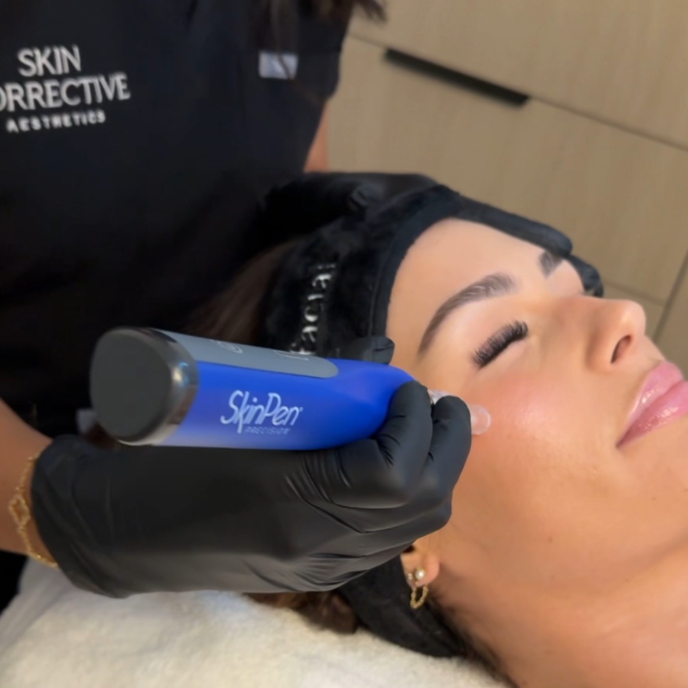 SkinPen Microneedling + LED at Skin Corrective Aesthetics in Dallas, TX
