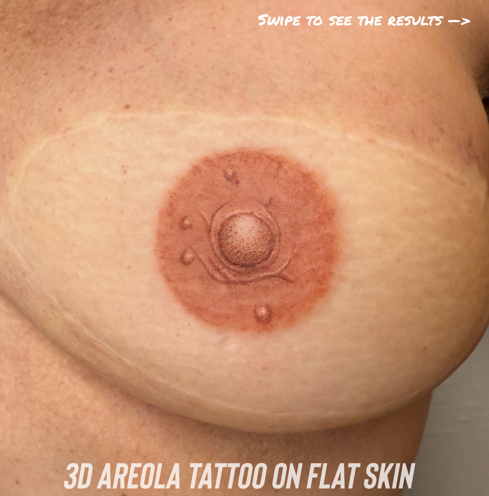 3D Areola Tattoo