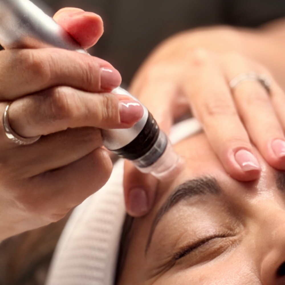 Signature HydroFacial at Smart Set Beauty in Chula Vista, CA